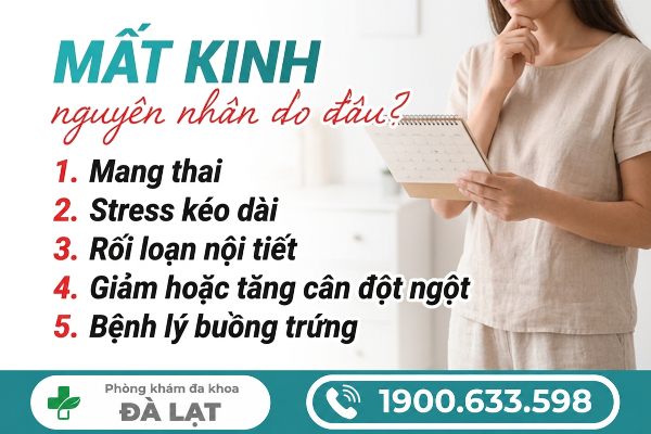 Hình ảnh minh họa